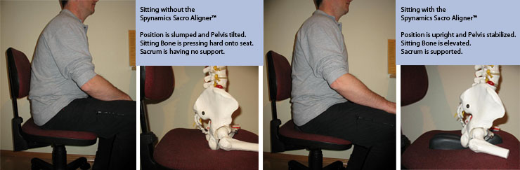 Aligner sitting position comparison